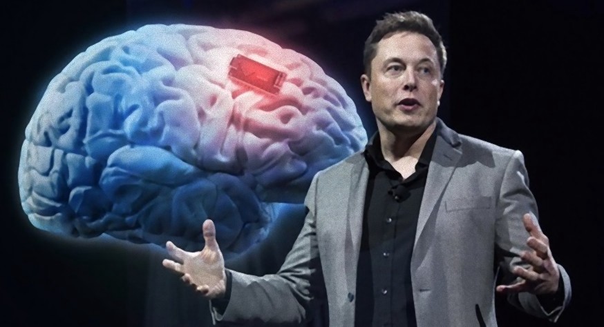 Implante cerebral de Elon Musk